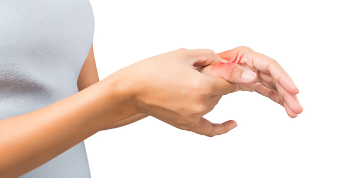 In more serious cases, thumb arthritis can be treated by one of several medical procedures that are available.