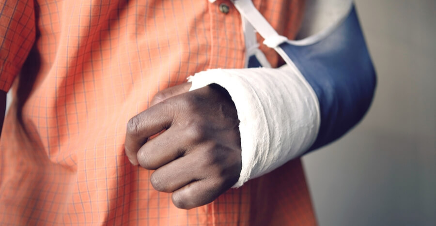 A broken wrist is shown in a closeup image. The man has a cast and sling.