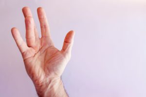 Dupuytren’s contracture develops over time and stems from the tissue in the palm.