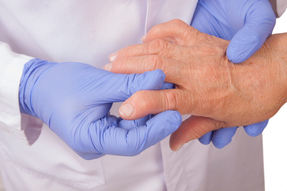 There are many differences between osteoarthritis and rheumatoid arthritis. The symptoms are similar, but the conditions are actually very different. This is a closeup image of a doctor examining a patient's hand arthritis.