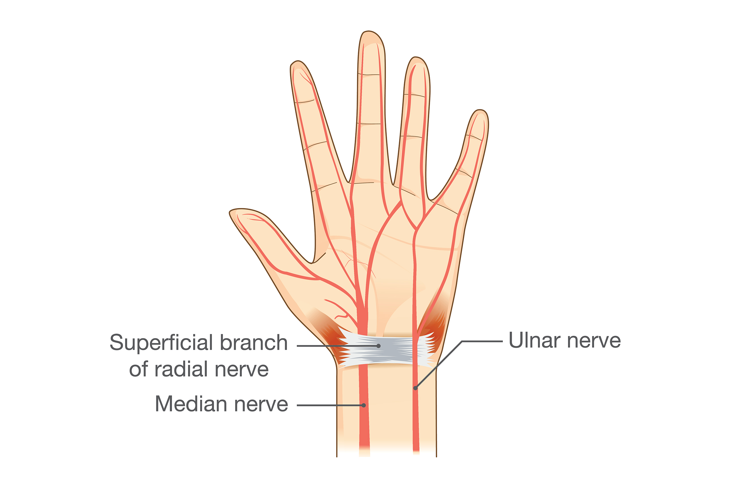 This drawing shows the three main nerves of the hand: the ulnar nerve, the median nerve, and the radial nerve.